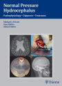 Normal Pressure Hydrocephalus: Pathophysiology - Diagnosis - Treatment