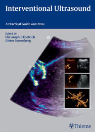 Title: Interventional Ultrasound: A Practical Guide and Atlas, Author: Christoph Frank Dietrich