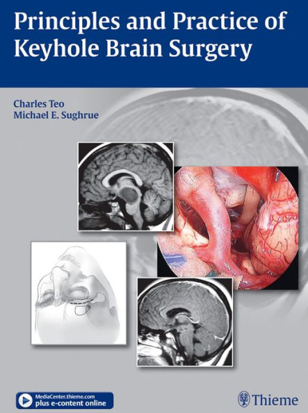 Principles and Practice of Keyhole Brain Surgery