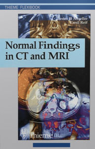 Title: Normal Findings in CT and MRI, Author: Torsten Bert Moeller