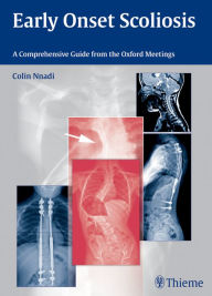 Title: Early Onset Scoliosis: A Comprehensive Guide from the Oxford Meetings, Author: Colin Nnadi