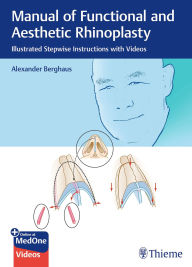 eBooks free download Manual of Functional and Aesthetic Rhinoplasty: Illustrated Stepwise Instructions with Videos by Alexander Berghaus in English  9783132582347