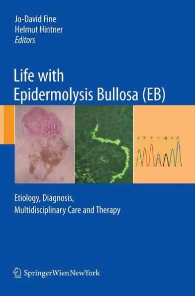 Life with Epidermolysis Bullosa (EB): Etiology, Diagnosis, Multidisciplinary Care and Therapy / Edition 1