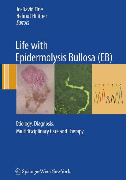 Life with Epidermolysis Bullosa (EB): Etiology, Diagnosis, Multidisciplinary Care and Therapy / Edition 1