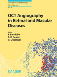 Title: OCT Angiography in Retinal and Macular Diseases, Author: F. Bandello