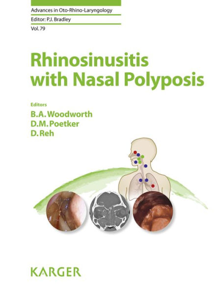 Rhinosinusitis with Nasal Polyposis: With a foreword by D.W. Kennedy (Philadelphia, Pa.)