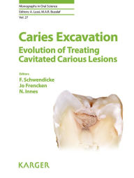 Title: Caries Excavation: Evolution of Treating Cavitated Carious Lesions, Author: F. Schwendicke