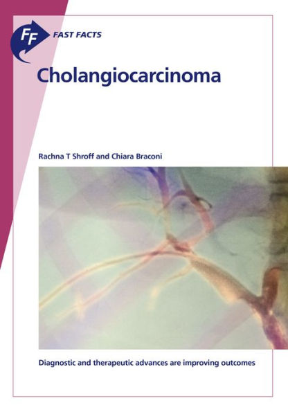 Fast Facts: Cholangiocarcinoma: Diagnostic and therapeutic advances are improving outcomes