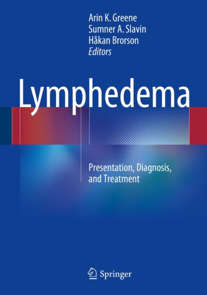 Lymphedema: Presentation, Diagnosis, and Treatment