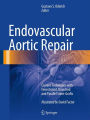 Endovascular Aortic Repair: Current Techniques with Fenestrated, Branched and Parallel Stent-Grafts