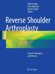 Downloading books for free online Reverse Shoulder Arthroplasty: Biomechanics, Clinical Techniques, and Current Technologies 9783319208398