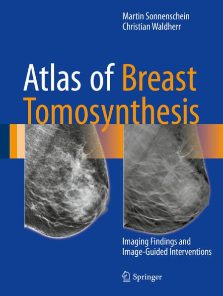 Atlas of Breast Tomosynthesis: Imaging Findings and Image-Guided Interventions
