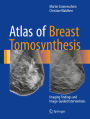 Atlas of Breast Tomosynthesis: Imaging Findings and Image-Guided Interventions