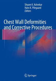 Ebooks free download audio book Chest Wall Deformities and Corrective Procedures