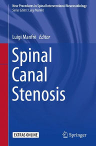 Free ebook download pdf Spinal Canal Stenosis 9783319262680 by Luigi Manfre