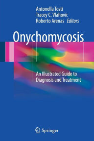 Title: Onychomycosis: An Illustrated Guide to Diagnosis and Treatment, Author: Antonella Tosti