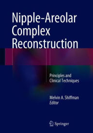 It books pdf free download Nipple-Areolar Complex Reconstruction: Principles and Clinical Techniques 9783319609249 PDF CHM (English literature) by Melvin A. Shiffman