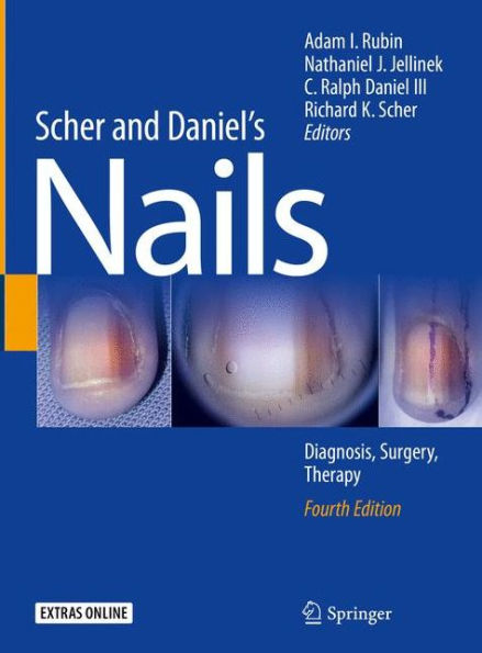 Scher and Daniel's Nails: Diagnosis, Surgery, Therapy / Edition 4