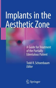 Title: Implants in the Aesthetic Zone: A Guide for Treatment of the Partially Edentulous Patient, Author: Todd R. Schoenbaum