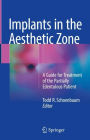 Implants in the Aesthetic Zone: A Guide for Treatment of the Partially Edentulous Patient