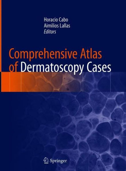 Comprehensive Atlas of Dermatoscopy Cases