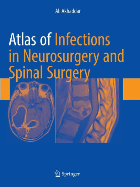 Atlas of Infections in Neurosurgery and Spinal Surgery