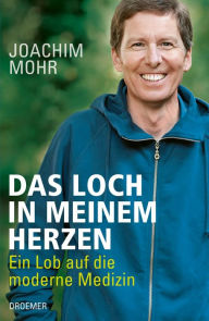 Title: Das Loch in meinem Herzen: Ein Lob auf die moderne Medizin, Author: Joachim Mohr