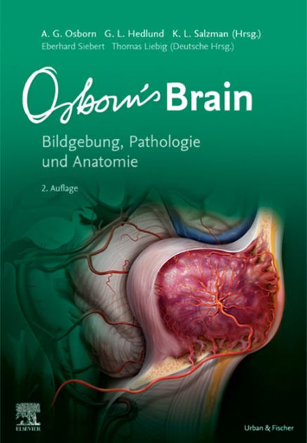 Osborn's Brain by Anne G. Osborn, Garry L. Hedlund, Karen L. Salzman ...