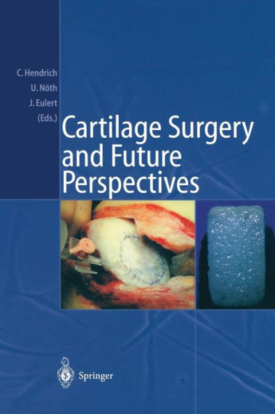 Cartilage Surgery and Future Perspectives