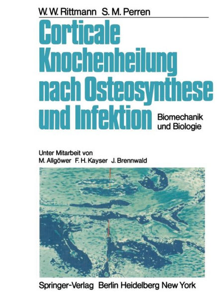 Corticale Knochenheilung nach Osteosynthese und Infektion: Biomechanik und Biologie