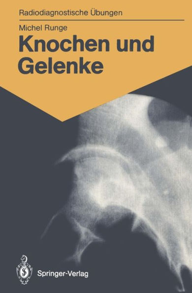 Knochen und Gelenke: 170 diagnostische ï¿½bungen fï¿½r Studenten und praktische Radiologen