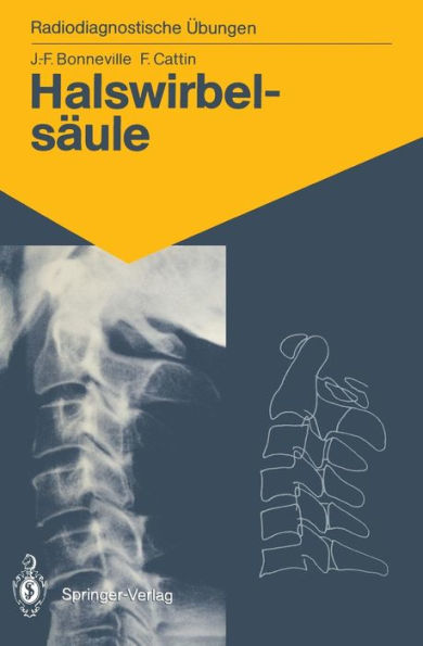 Halswirbelsäule: 60 diagnostische Übungen für Studenten und praktische Radiologen