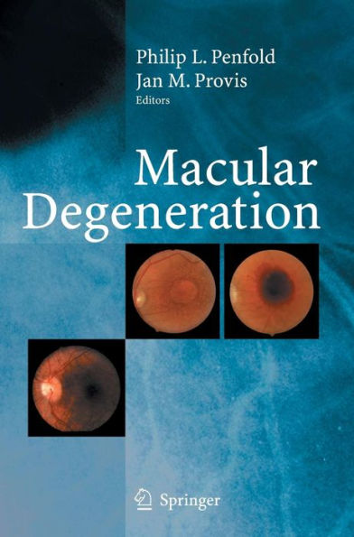 Macular Degeneration / Edition 1