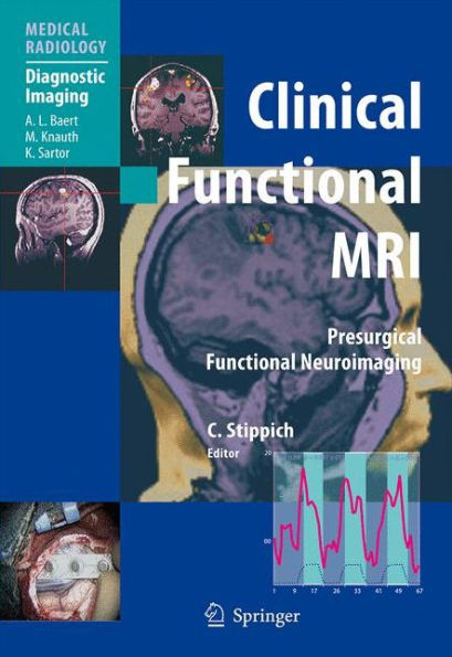 Clinical Functional MRI: Presurgical Functional Neuroimaging / Edition 1