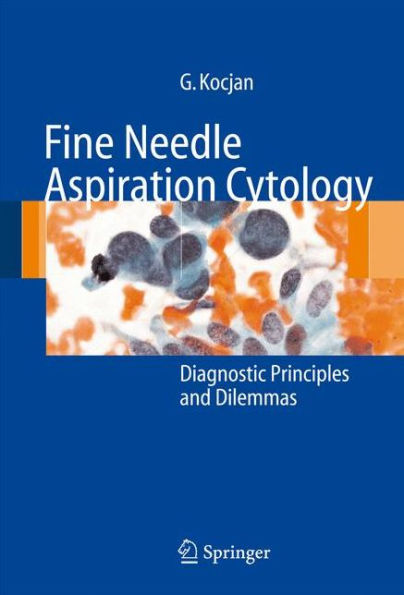 Fine Needle Aspiration Cytology: Diagnostic Principles and Dilemmas / Edition 1