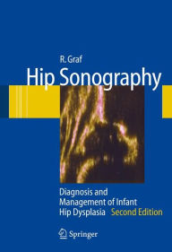 Title: Hip Sonography: Diagnosis and Management of Infant Hip Dysplasia / Edition 2, Author: R. Graf
