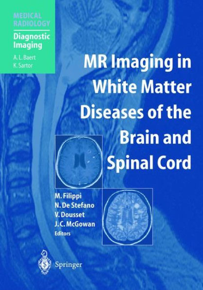 MR Imaging in White Matter Diseases of the Brain and Spinal Cord / Edition 1