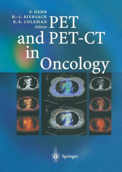 PET and PET-CT in Oncology / Edition 1