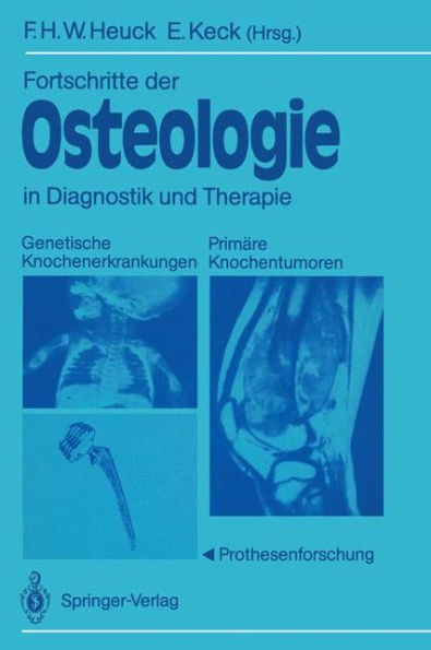 Fortschritte der Osteologie in Diagnostik und Therapie: Genetische Knochenerkrankungen Primï¿½re Knochentumoren ï¿½ Prothesenforschung Osteologia 3