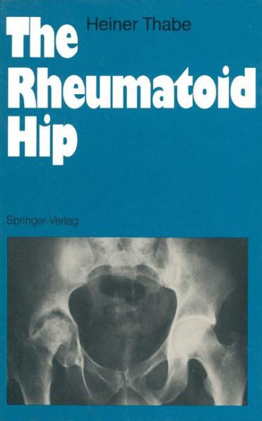 The Rheumatoid Hip / Edition 1
