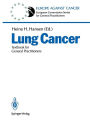 Lung Cancer: Textbook for General Practitioners / Edition 1