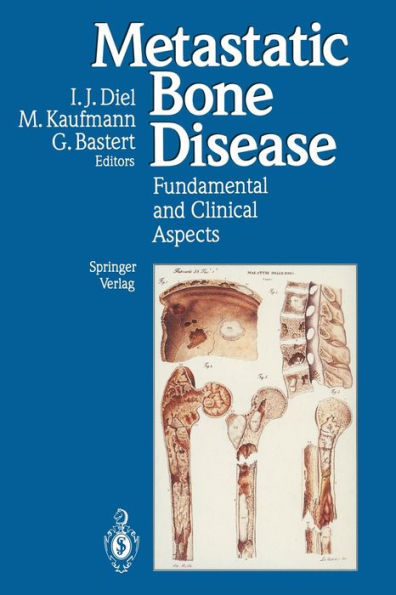 Metastatic Bone Disease: Fundamental and Clinical Aspects