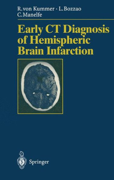 Early CT Diagnosis of Hemispheric Brain Infarction / Edition 1
