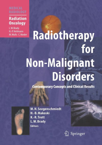 Radiotherapy for Non-Malignant Disorders / Edition 1