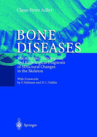 Title: Bone Diseases: Macroscopic, Histological, and Radiological Diagnosis of Structural Changes in the Skeleton / Edition 1, Author: Claus-Peter Adler