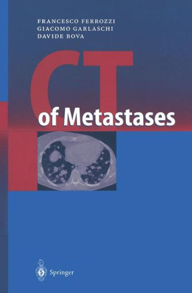 CT of Metastases / Edition 1