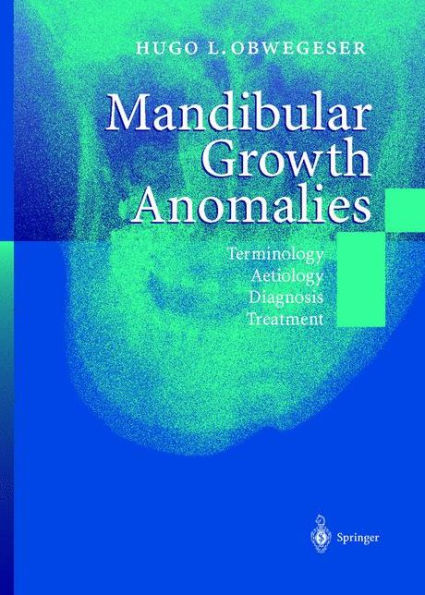 Mandibular Growth Anomalies: Terminology - Aetiology Diagnosis - Treatment / Edition 1
