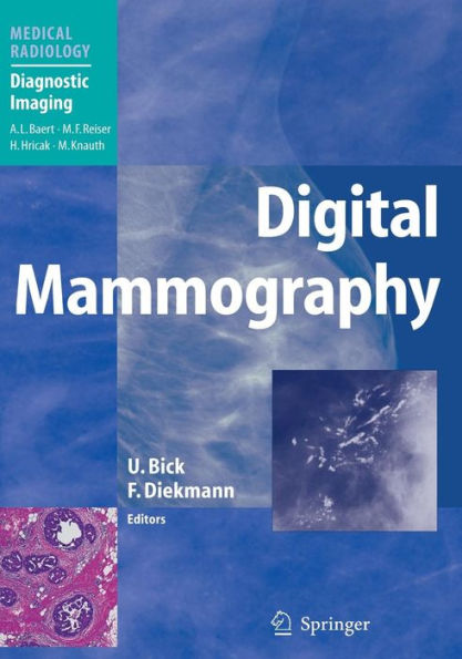 Digital Mammography / Edition 1