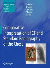 Title: Comparative Interpretation of CT and Standard Radiography of the Chest / Edition 1, Author: Emmanuel E. Coche