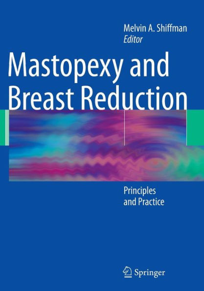 Mastopexy and Breast Reduction: Principles and Practice / Edition 1